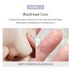 celimax Derma Nature Fresh Blackhead Jojoba Cleansing Oil | Light & Non-Greasy Daily Makeup Remover, Facial Cleanser, Clogged Pore & Blackheads Removal, Deep Cleansing,150ml